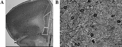 Work done in the Microscopy Suite is shown. Side A shows the outlines of various subregions of the prefrontal cortex of the brain that were analyzed and Side B is magnified to show cells that were being counted.