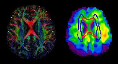 Brightly multicolored brain scans
