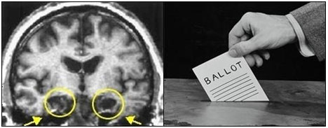 Image of MRI and Ballot Box