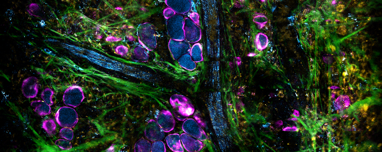 The 2D visualization of the extracellular vesicles in the tumor microenvironment highlighting the presence of NAD(P)H rich scattered along the blood vessels. The photo was featured on the cover of the November 2019 issue of the Proceedings of the National Academy of Sciences.