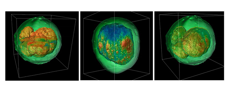 Bovine embryos imaged by gradient light interference microscopy (GLIM)