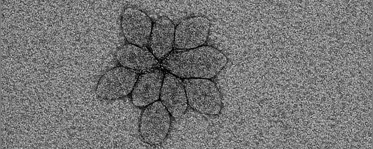 This cluster of Sulfolobus spindle-shaped viruses was captured using the transmission electron microscope (TEM) in the Microscopy Suite at Beckman. These viruses are unique in the fact that they only infect members of the order Sulfolobales, a type of hyperthermophilic archaea that resides in the acidic hot springs in Yellowstone National Park and the Kamchatka Peninsula in Russia.