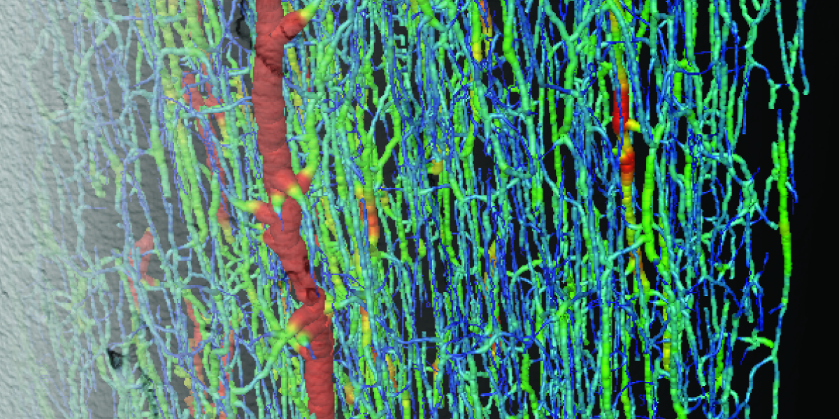 Bone image Bone image from Visualization Laboratory