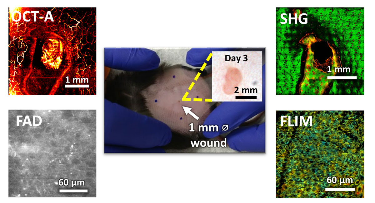 Different imaging techniques for wound healing. OCT-A shows the development of blood vessels, SHG shows collagen reorganization around the wound, FAD and FLIM images provide chemical information about the imaged area.