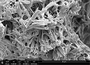 Mineralized collagen scaffolds display an altered microstructure with zinc supplementation. Traditionally, these scaffolds have plate-like crystals but once zinc is added the crystals become elongated.