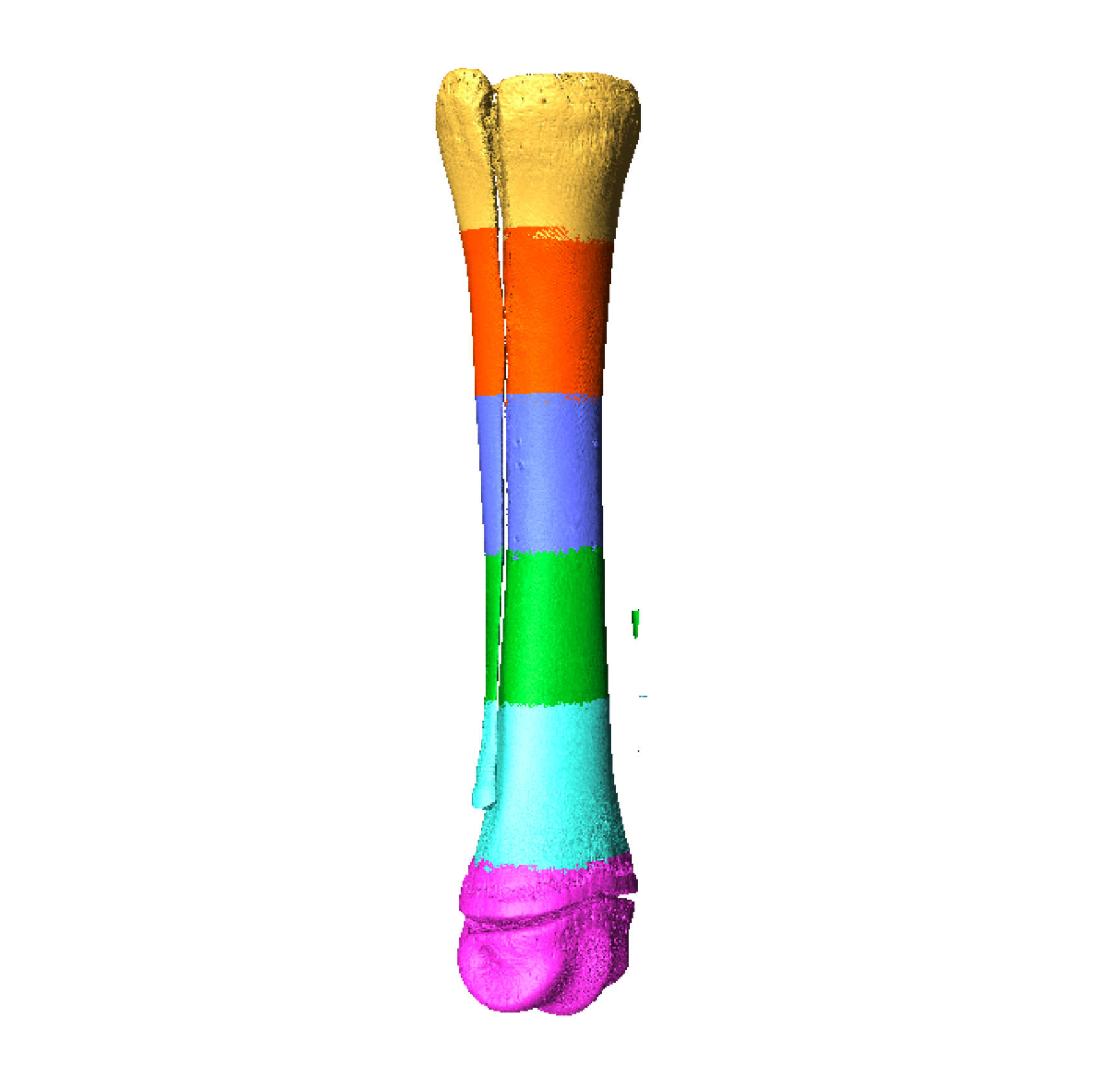 An image of a cannon bone in a young horse. From bottom to top, the bone is separated into pink, light blue, green, dark blue, orange, and yellow areas,