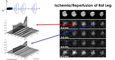 MR Imaging using low-rank tensor models