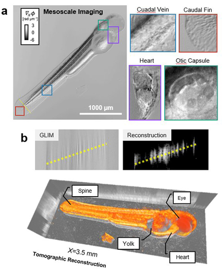 Images illustrating a new imaging technique called Epi-illumination Gradient Light Interference Microscopy.