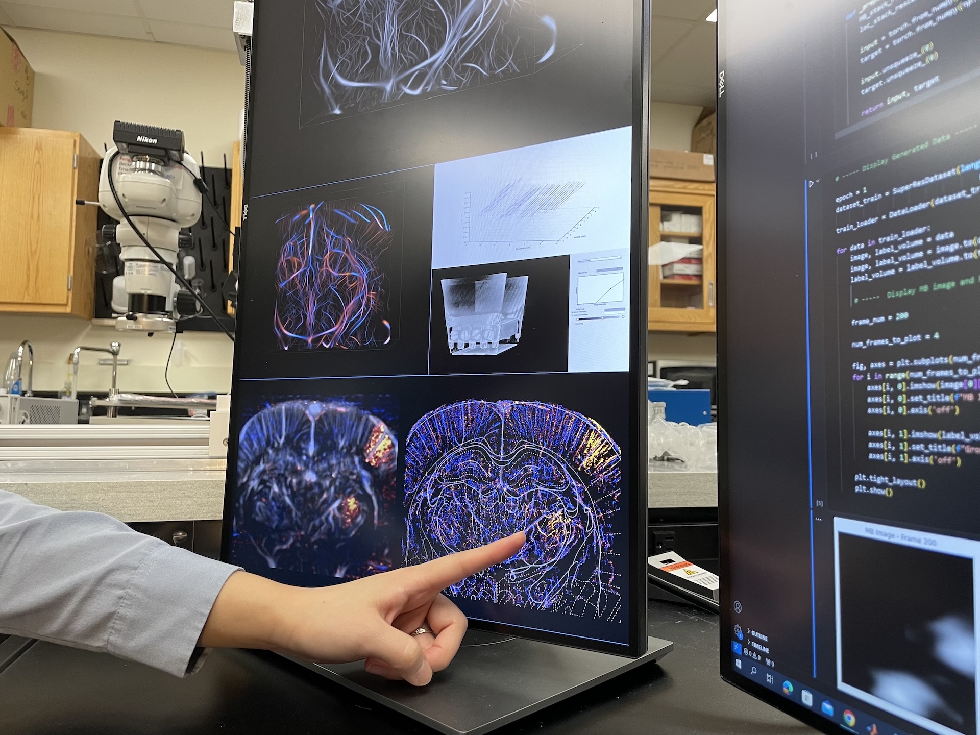 Looking at an ultrasound image, Shin points to a region of the brain showing strong microbubble activity from a nerve stimulation test. 