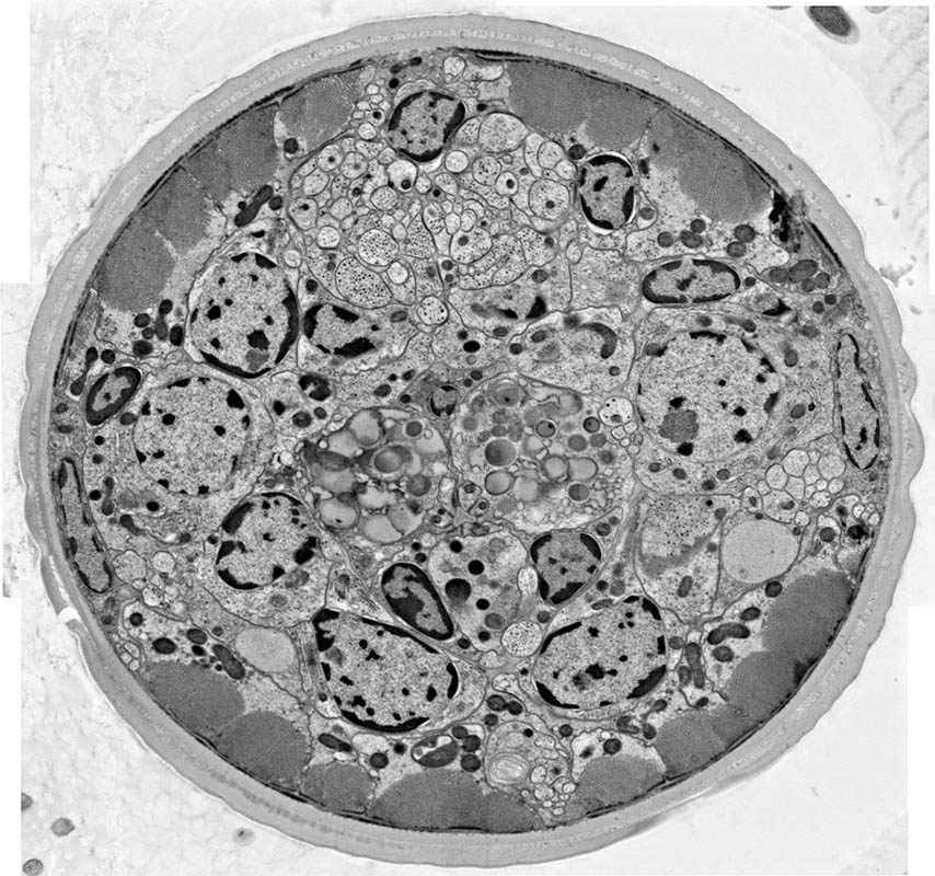 Electron micrograph of a soybean cyst nematode cross section