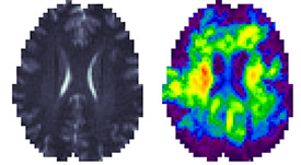 Brain Scans