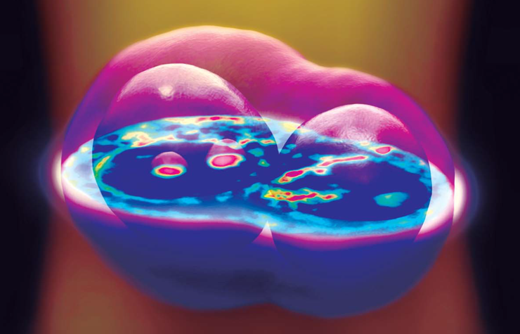 Label-free imaging of a cell