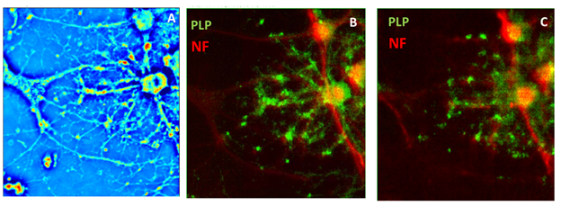 SLIM image of oligodendrocyte enveloping the axon of a neuron, the corresponding fluorescent channels, and the artificially generated fluorescence from the SLIM frame