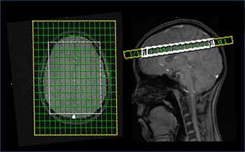 Image of magnetic resonance spectroscopy imaging