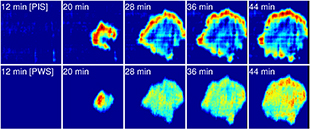 Photonic Resonator Outcoupler Microscopy (PROM) image that highlights focal adhesions of live dental stem cells.