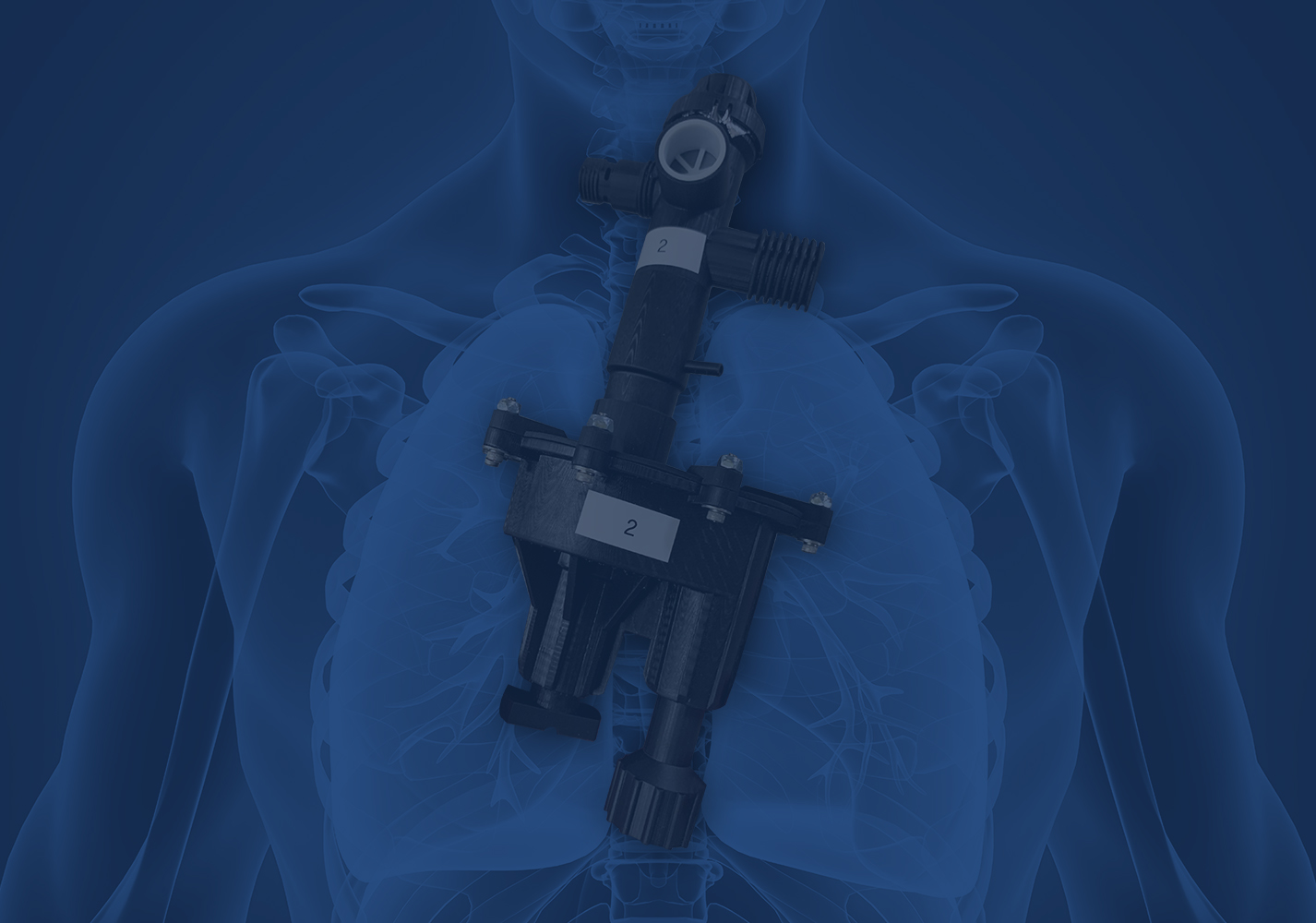 RapidVent illustration RapidVent shown with an illustration of human lungs