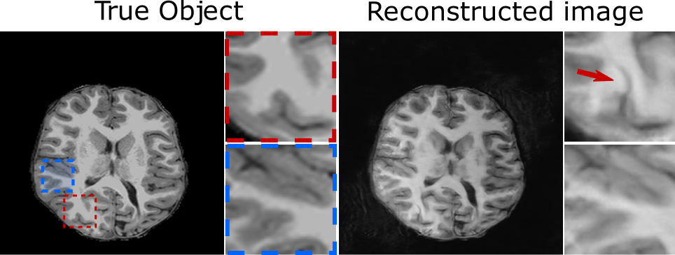 Figure showing two common types of tomographic hallucinations introduced through image reconstruction