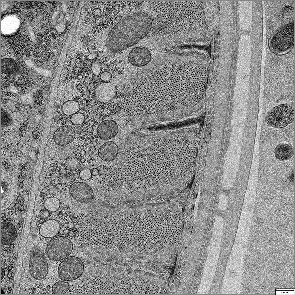 A transmission electron micrograph showing a healthy muscle cell in an adult Caenorhabditis elegans nematode.