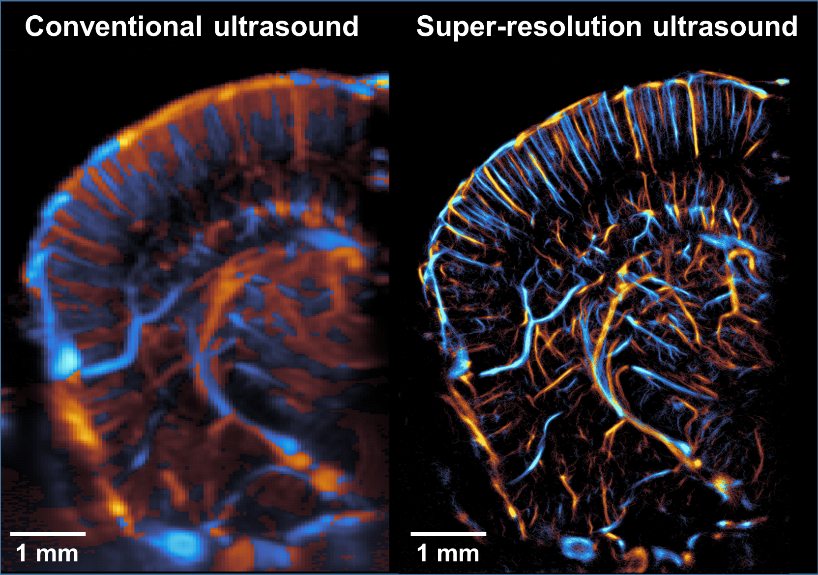 Comparison between conventional directional Doppler ultrasound imaging and ultrasound super-resolution algorithm of a mouse brain.