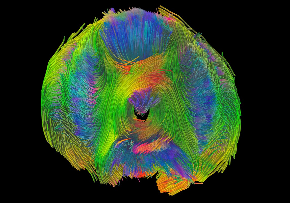  Three-dimensional muscular organization of an octopus arm.