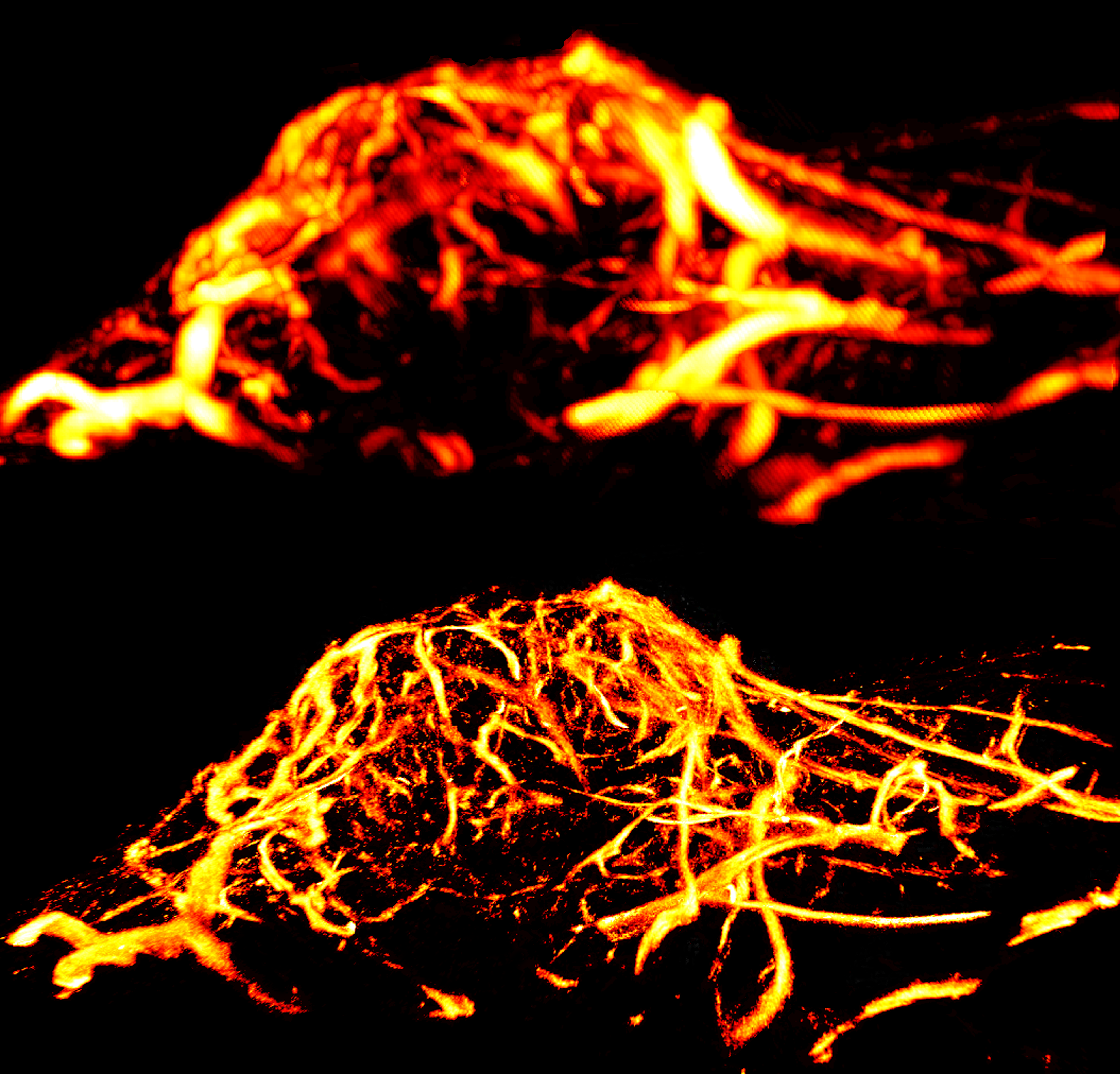 Contrast between two ultrasound imaging techniques used to image the microvasculature of a mouse's brain. The image generated using ultrasound localization microscopy is much finer and clearer than the image generated using power doppler imaging.