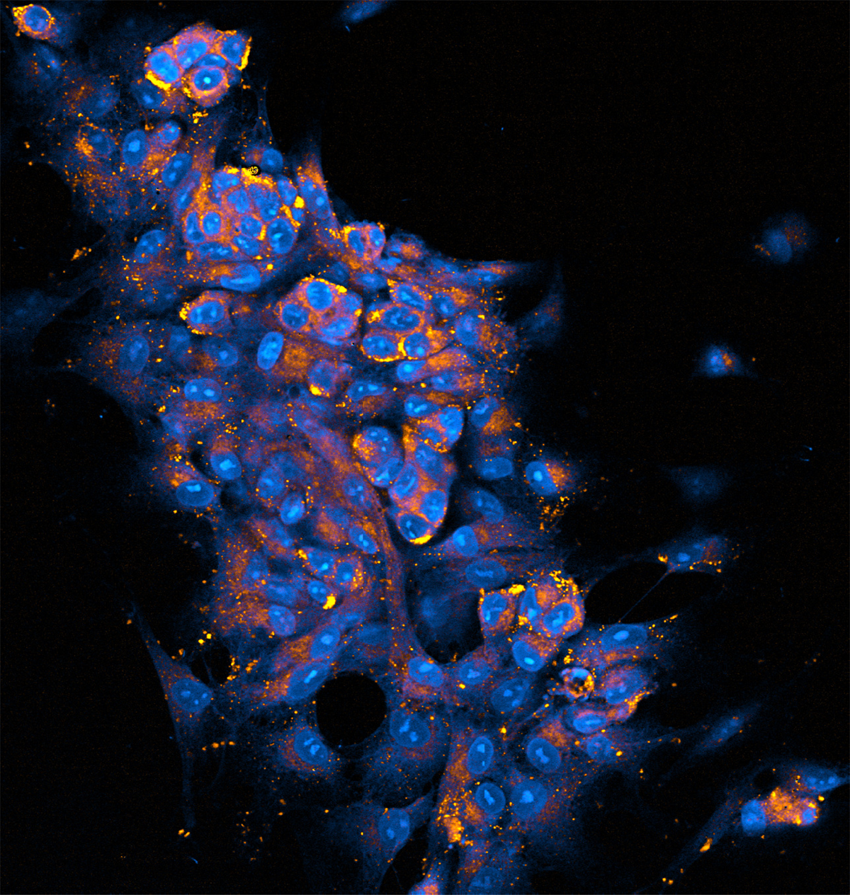 A stimulated Raman scattering microscopy image shows a co-culture of colon cancer cells and fibroblasts embedded in hydrogel matrix.