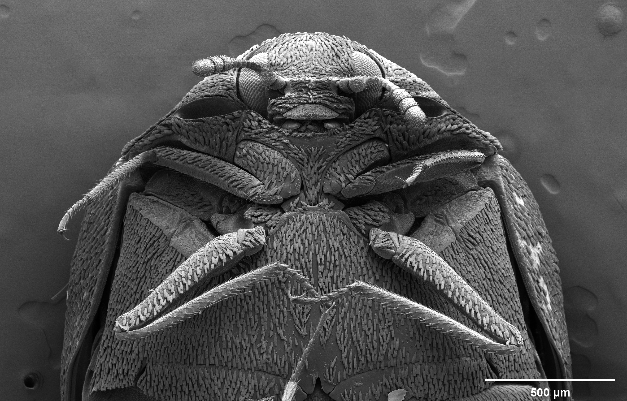 Microscopic image of a dermestid, or skin beetle.