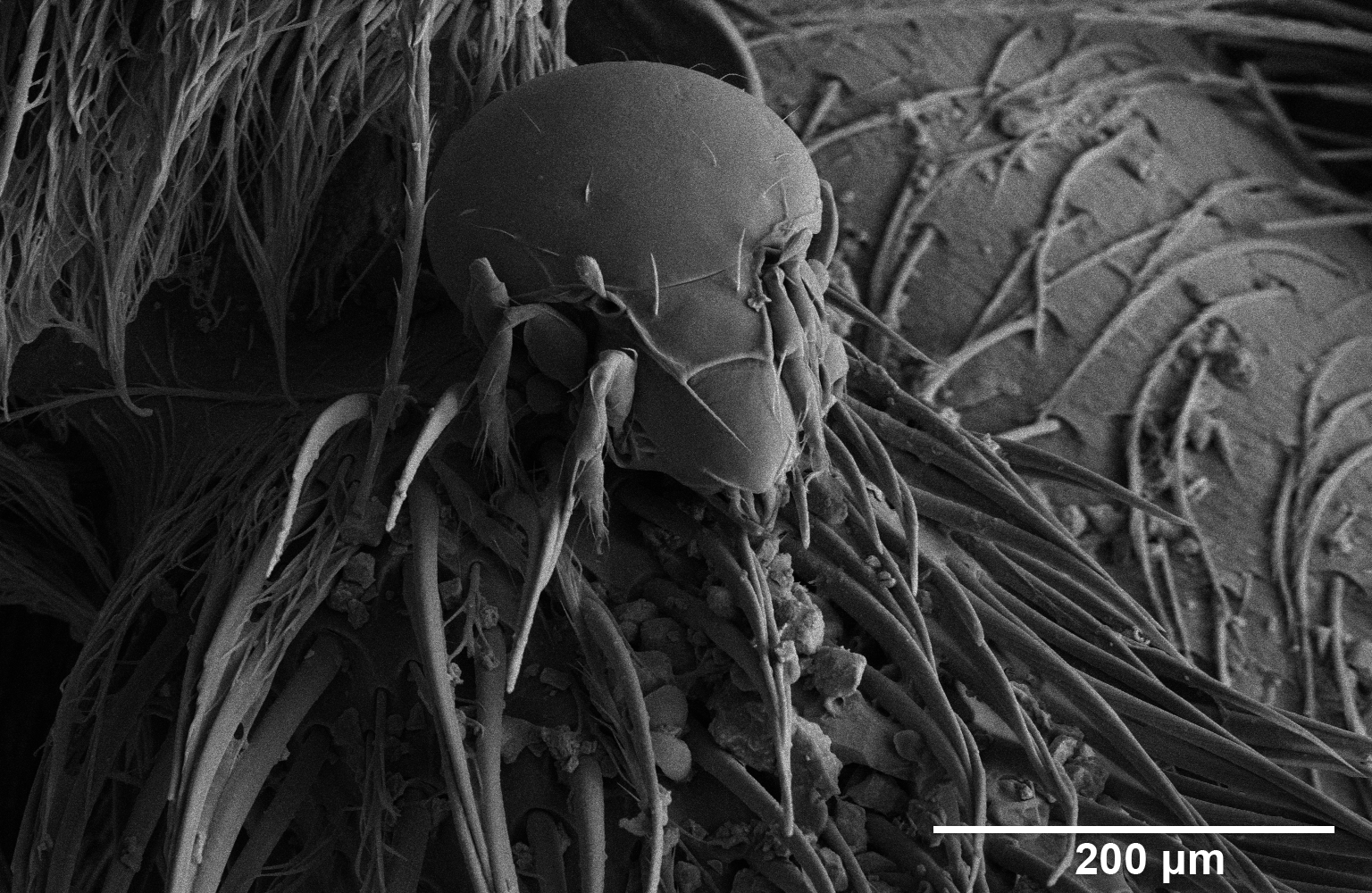 Microscopic image of a mite.