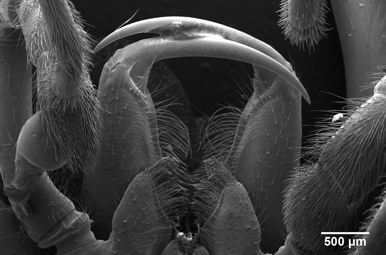 Microscopic image of spider fangs.