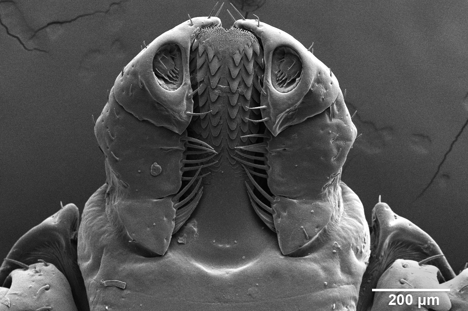 Microscopic image of a tick.