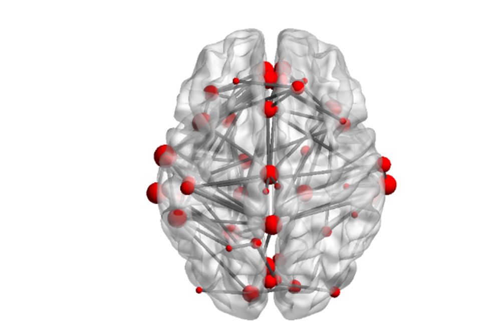 brain-rendered connectivity graph 