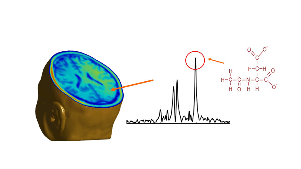 An image illustrating the capability of advanced computational imaging to map brain metabolites and neurotransmitters.