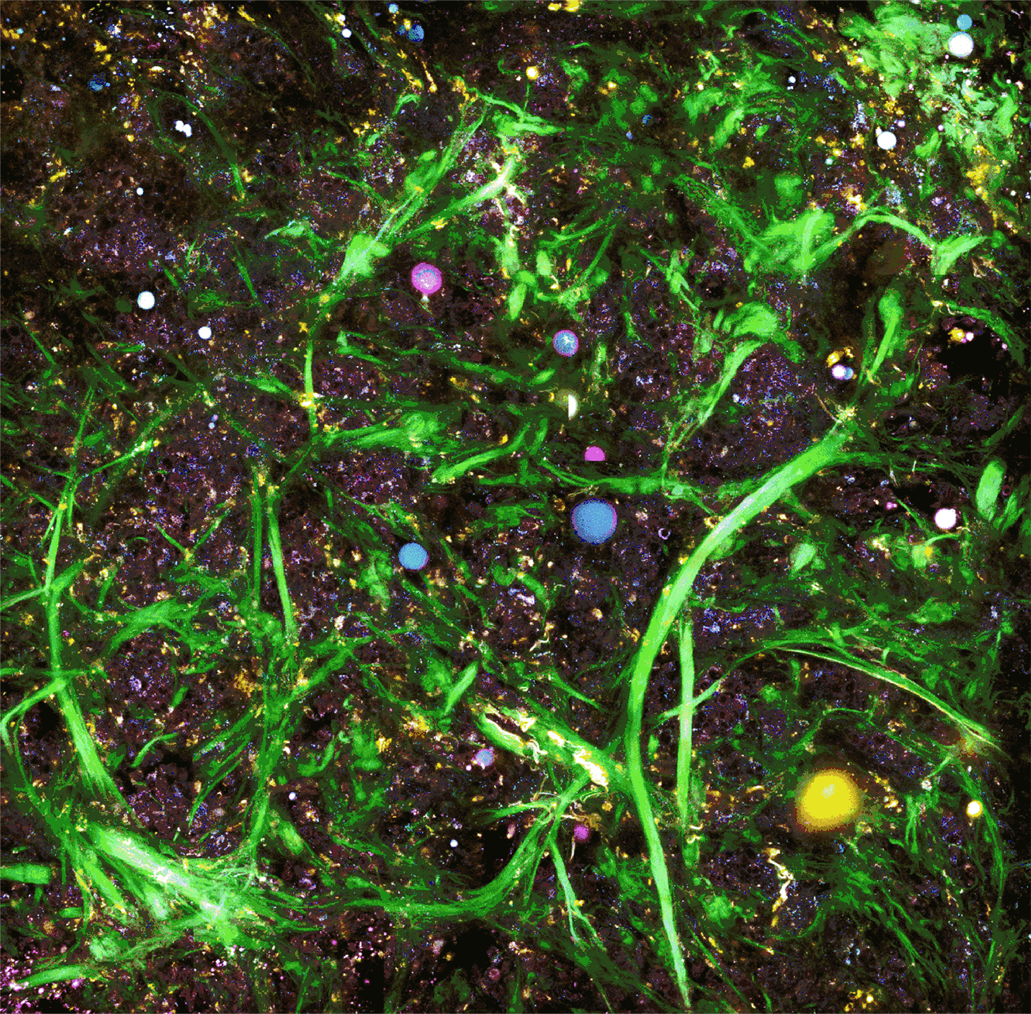 A four-channel multiphoton image of cancer cells