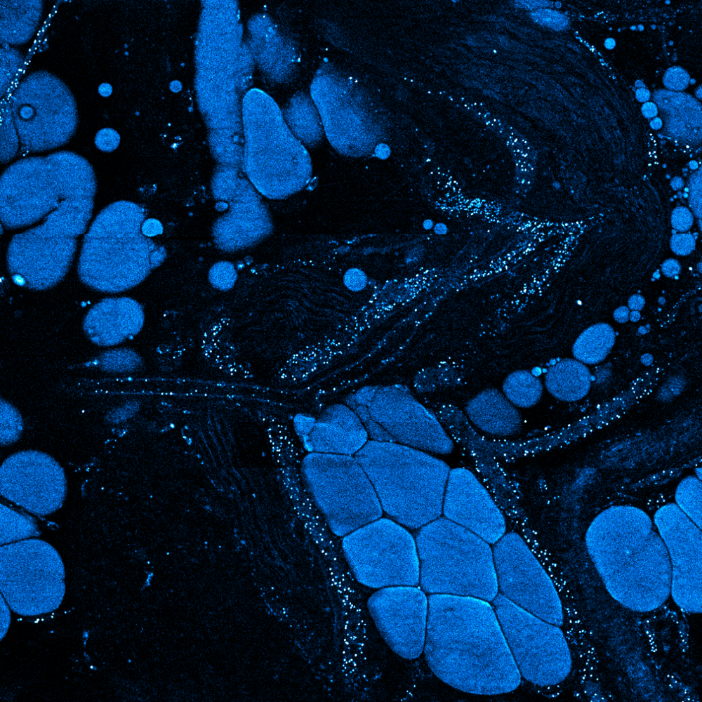 Lalel-free in vivo image of extracellular vesicles, which show up bright blue against a black background