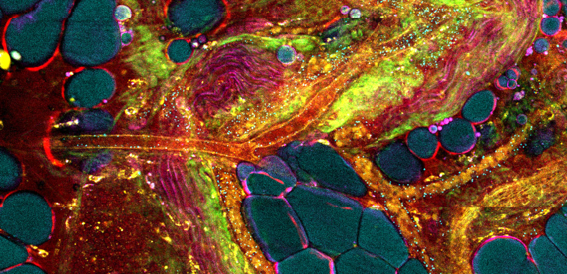 A close-up image of extracellular vesicles, with dark spots near areas of orange and yellow