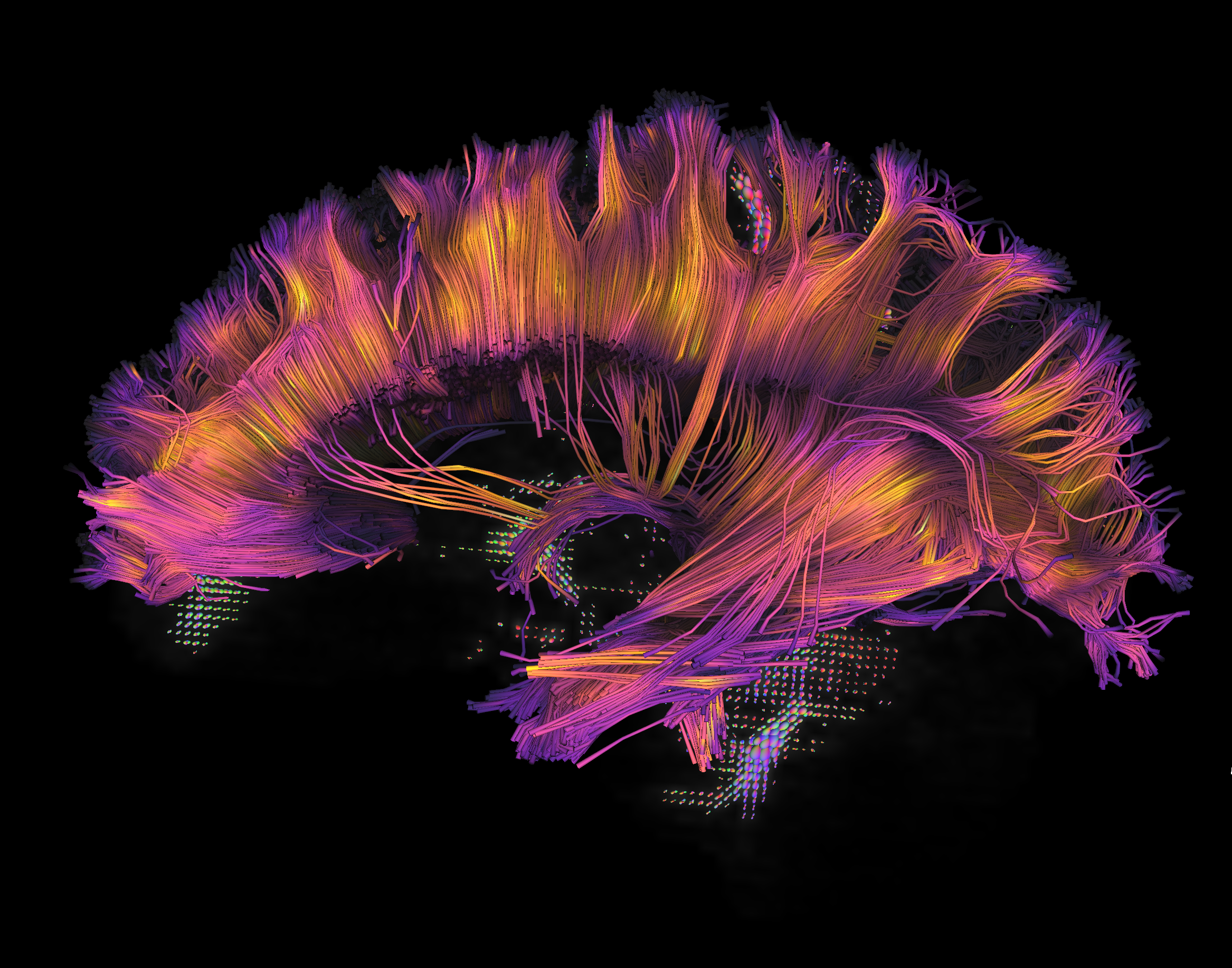 A 7 Tesla image of a human brain.