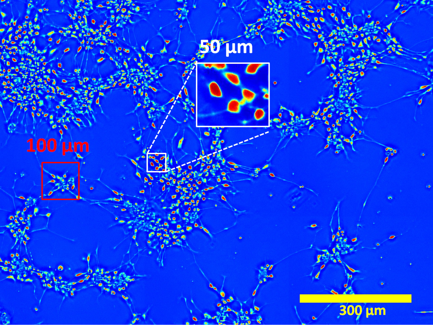 A close-up look at neurons using spatial light interference microscopy