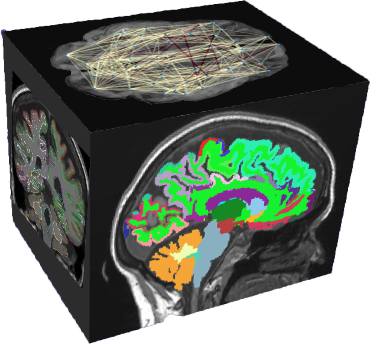 Cube facets with different brain images